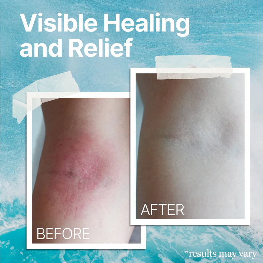 Evoulix™ Eczema Relief Cream